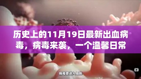 温馨日常的守护者,病毒来袭的守护故事,历史上的11月19日最新出血病毒事件
