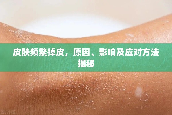 皮肤频繁掉皮,原因、影响及应对方法揭秘