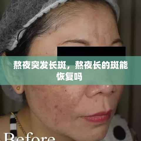 熬夜突发长斑,熬夜长的斑能恢复吗