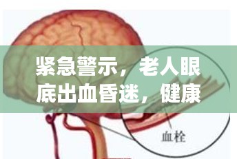 紧急警示，老人眼底出血昏迷，健康危机需警惕